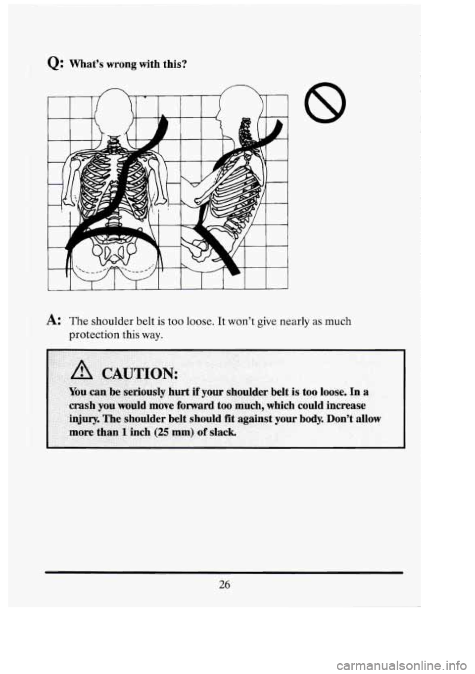 CADILLAC FLEETWOOD 1994  Owners Manual Q: Vvnars wrong with this? 
3 
I 1 I I I I I I 1 I I I 
8 
,& The shoulder  belt is too loose.  It wont  give  nearly as much 
protection  this way. 
26 
7 U  