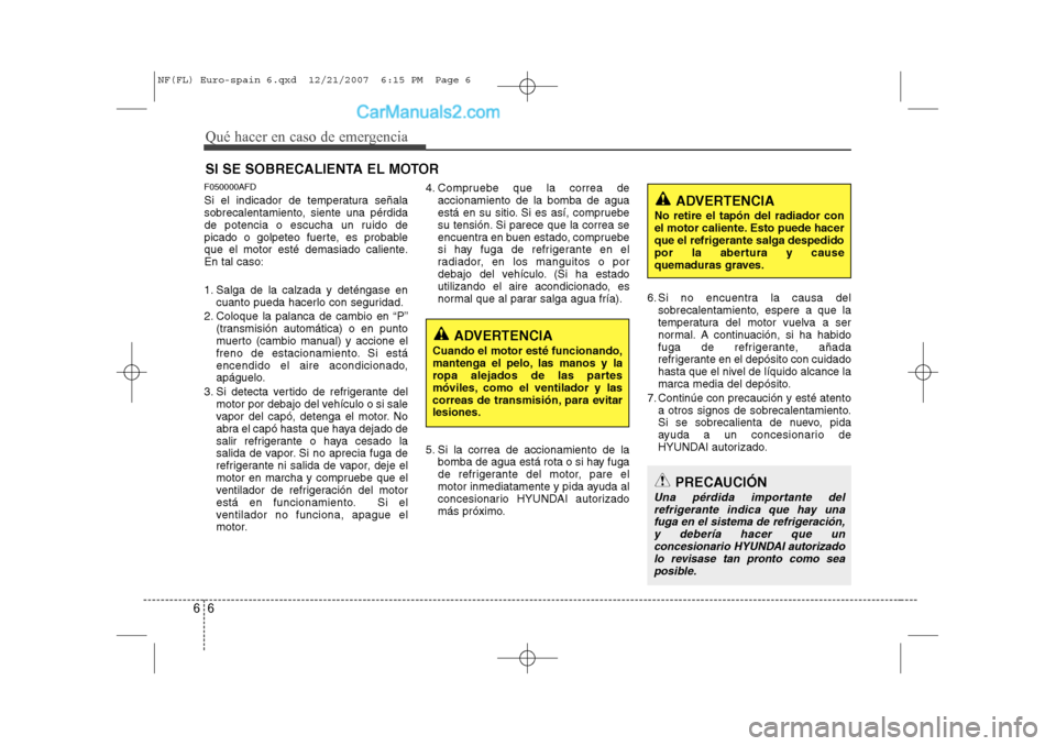 Hyundai Sonata 2008 Manual del propietario (in Spanish) Qué hacer en caso de emergencia
6
6
SI SE SOBRECALIENTA EL MOTOR
F050000AFD
Si el indicador de temperatura señala
sobrecalentamiento, siente una pérdida
de potencia o escucha un ruido de
picado o Hyundai Sonata 2008 Manual del propietario (in Spanish) Qué hacer en caso de emergencia
6
6
SI SE SOBRECALIENTA EL MOTOR
F050000AFD
Si el indicador de temperatura señala
sobrecalentamiento, siente una pérdida
de potencia o escucha un ruido de
picado o