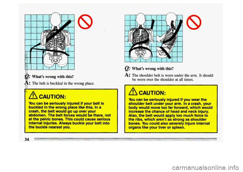 BUICK CENTURY 1993  Owners Manual n 
r 
I I I I I I I 
@ What’s  wrong  with  this? 
A: The  belt  is  buckled  in  the  wrong  place. 
I 
A CAUTION’: 
ybu  can  be seriously  injured if your belt is 
buckled  in the 
wrong place 