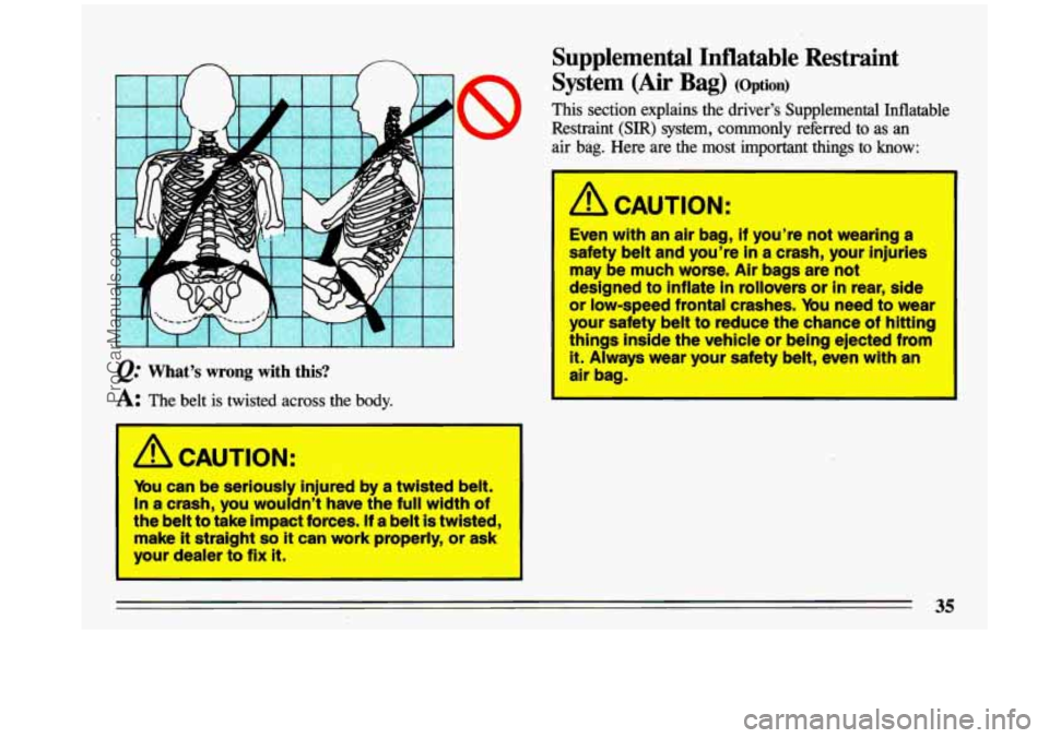 BUICK CENTURY 1993  Owners Manual I I I I I I I I I I I J 
@ What’s  wrong  with  this? 
A: The belt  is  twisted  across  the  body. 
Mu can be seriously injured  by  a twisted  belt. 
In a  crash,  you  wouldn’t  have  the full 