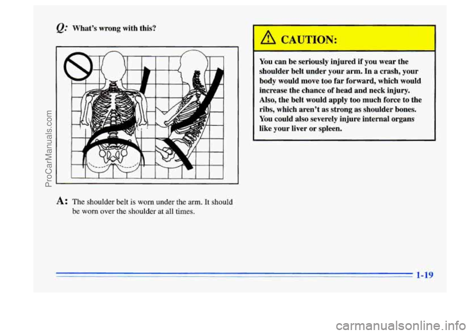 BUICK CENTURY 1996  Owners Manual @ What’s wrong with this? 
A 
A: The  shoulder belt is worn under the  arm. It should 
be  worn  over the shoulder  at all  times. 
A C TION: 
You  can be seriously  injured if you wear  the 
should