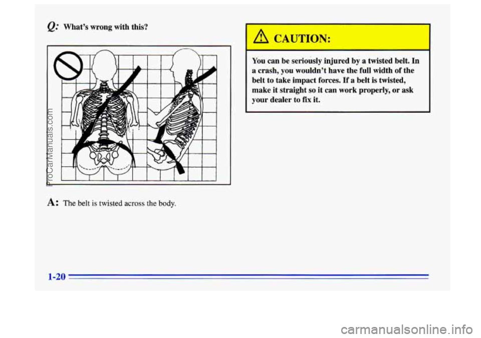 BUICK CENTURY 1996  Owners Manual &.’ What’s  wrong  with  this? 
A: The belt is twisted across the body. 
A I- QUTION: 
You  can  be  seriously  injured  by  a  twisted  belt.  In 
a  crash, 
you wouldn’t  have  the  full  widt