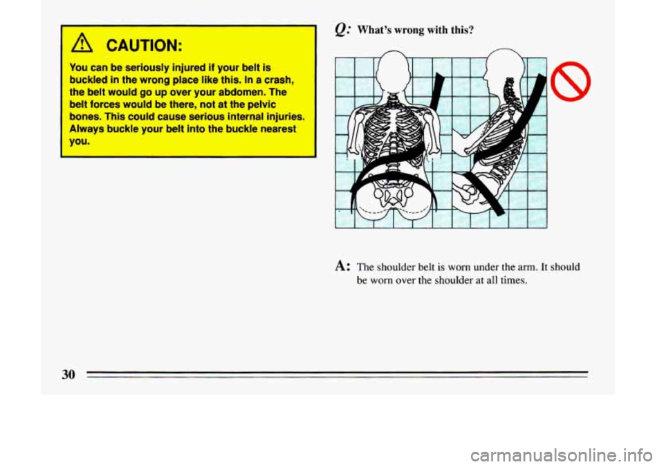 BUICK LESABRE 1993  Owners Manual 1 A CAUTION: 
You can  be  seriously  injured if your  belt is 
buckled in the  wrong  place  like this. In a  crash, 
the  belt would 
go up over  your  abdomen.  The 
belt  forces  would be  there, 