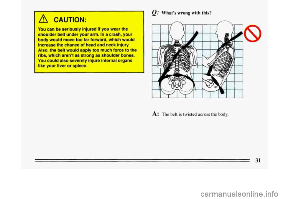 BUICK LESABRE 1993  Owners Manual /11 CAUTION: 
You can be seriously  injured if you wear  the 
shoulder  belt under  your arm. 
In a  crash,  your 
body would  move 
too far  forward, which would 
increase  the  chance 
of head  and 