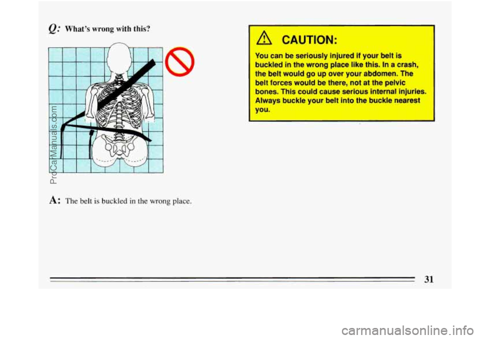 BUICK PARK AVENUE 1993  Owners Manual You can be  seriously  injured if your belt is 
buckled in the wrong  place like this. In a crash, 
the  belt  would  go  up over  your  abdomen.  The 
belt  forces  would be  there, 
not at the pelvi