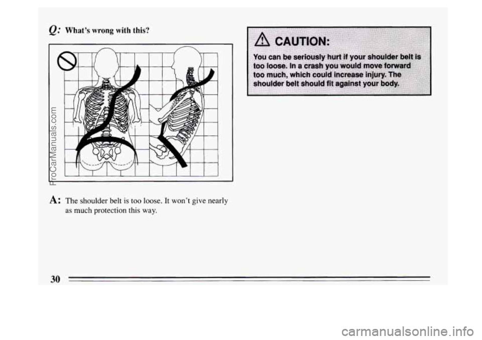 BUICK PARK AVENUE 1994  Owners Manual @ What’s wrong with this? 
I 
I I I  I I I  I I I I  I 
A: The shoulder belt is too loose. It won’t  give nearly 
as much protection this  way. 
30 
ProCarManuals.com 