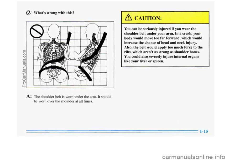 BUICK PARK AVENUE 1996  Owners Manual @ What’s  wrong  with  this? 
You can be seriously  injured if you wear the 
shoulder  belt under  your  arm.  In a crash,  your 
body  would  move 
too far forward,  which  would 
increase  the  ch