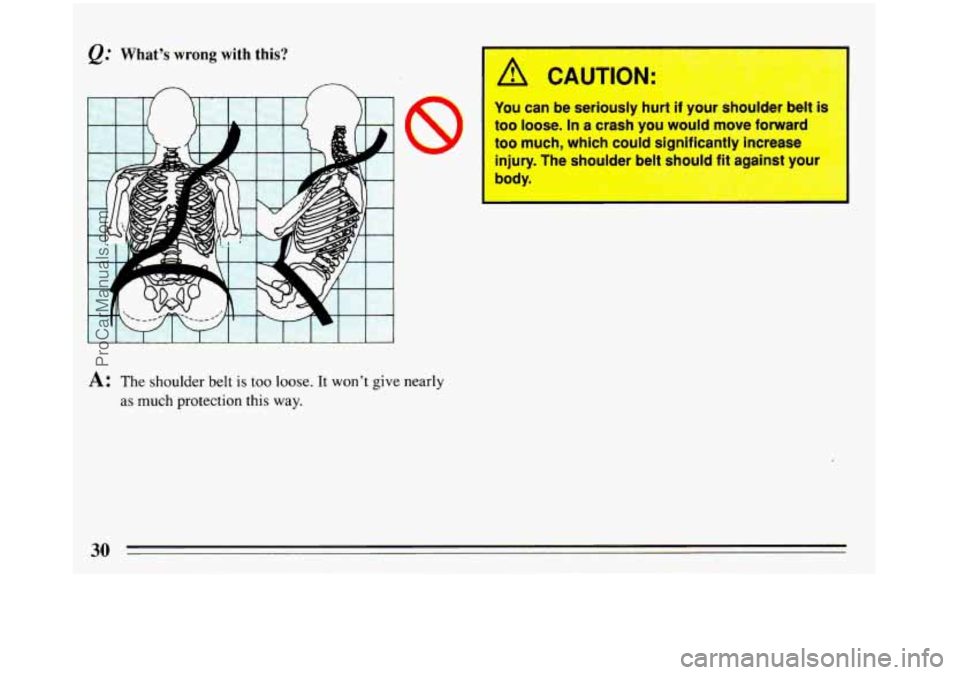 BUICK REGAL 1993  Owners Manual @ What’s wrong with this? 
A: The shoulder  belt is too loose. It won’t give nearly 
as  much protection this  way. 
A CAUTION: 
You can  be  seriously  hurl II your snoulder  belt is 
too  loose.