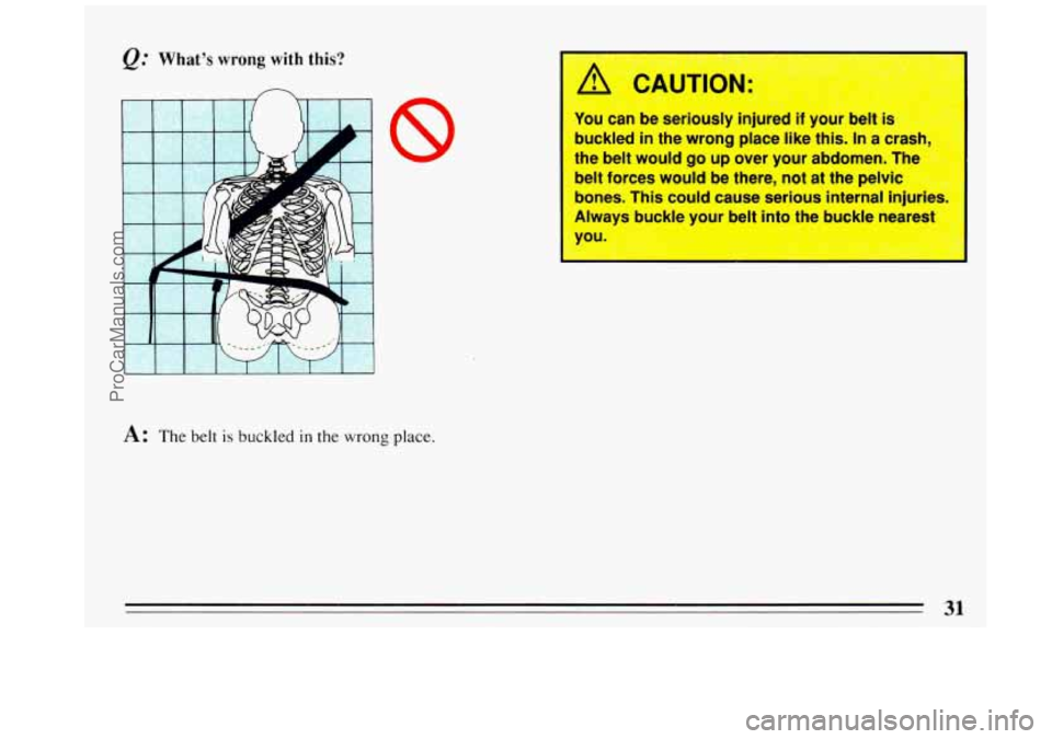 BUICK REGAL 1993  Owners Manual @ What’s wrong with this? 
n 
8 
A: The belt is buckled in the wrong place. 
A CAUTIOP 
fou can be seriously  injured if your Delt is 
buckled in the wrong  place like this. In a crasn, 
the  belt  