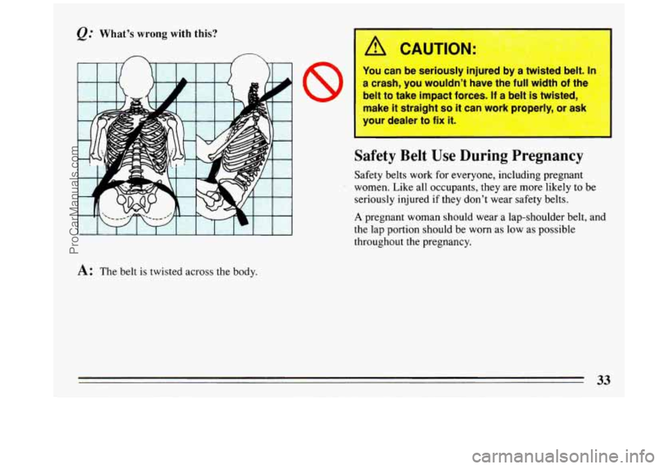 BUICK REGAL 1993  Owners Manual @ What’s wrong with this? 
I I I 
A: The belt is twisted  across  the  body. 
j /r CAUTION: 
You can  be  seriously  injured  by a twisted  belt. In I 
a  crash,  you  wouldn’t  have  the  full wi