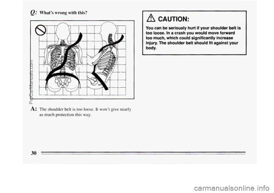 BUICK REGAL 1994  Owners Manual Whats wrong with this? 
t 
A: The shoulder belt is too loose. It wont give nearly 
as much  protection this way. 
. .. , , ,, .. .  . . .. . . r_ 
You  can be seriously hurt if your shoulder be&& 
