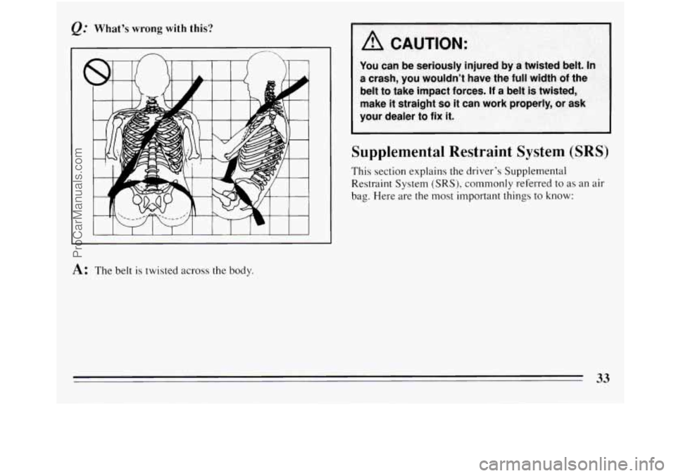 BUICK REGAL 1994  Owners Manual &.’ What’s  wrong  with  this? 
I I  I I 1 I I 1 I 1 I 
A: The belt is twisted across the  body. 
Supplemental Restraint System (SRS) 
This section explains the driver’s  Supplemental 
Restraint