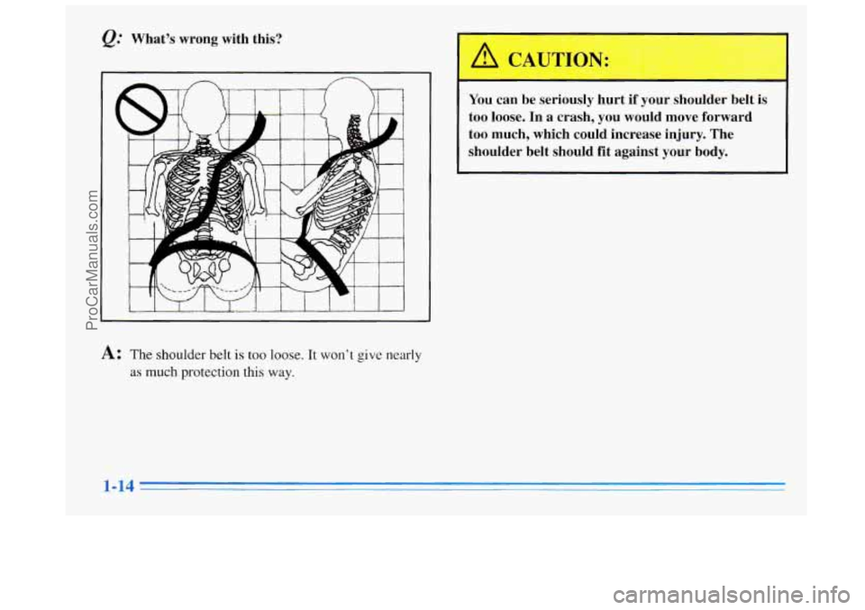 BUICK REGAL 1996  Owners Manual @ What’s  wrong  with  this? 
You can  be  seriously  hurt if your  shoulder  belt  is 
too 
loose. In  a  crash,  you  would move forward 
too  much,  which  could  increase  injury. 
The 
shoulder