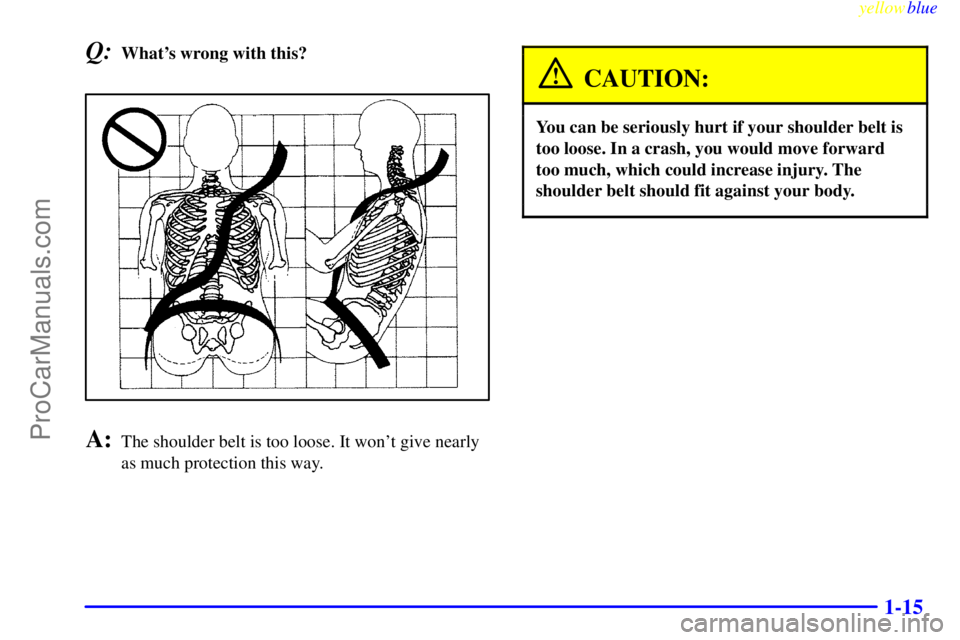 BUICK REGAL 1999  Owners Manual yellowblue     
1-15
Q:Whats wrong with this?
A:The shoulder belt is too loose. It wont give nearly
as much protection this way.
CAUTION:
You can be seriously hurt if your shoulder belt is
too loose