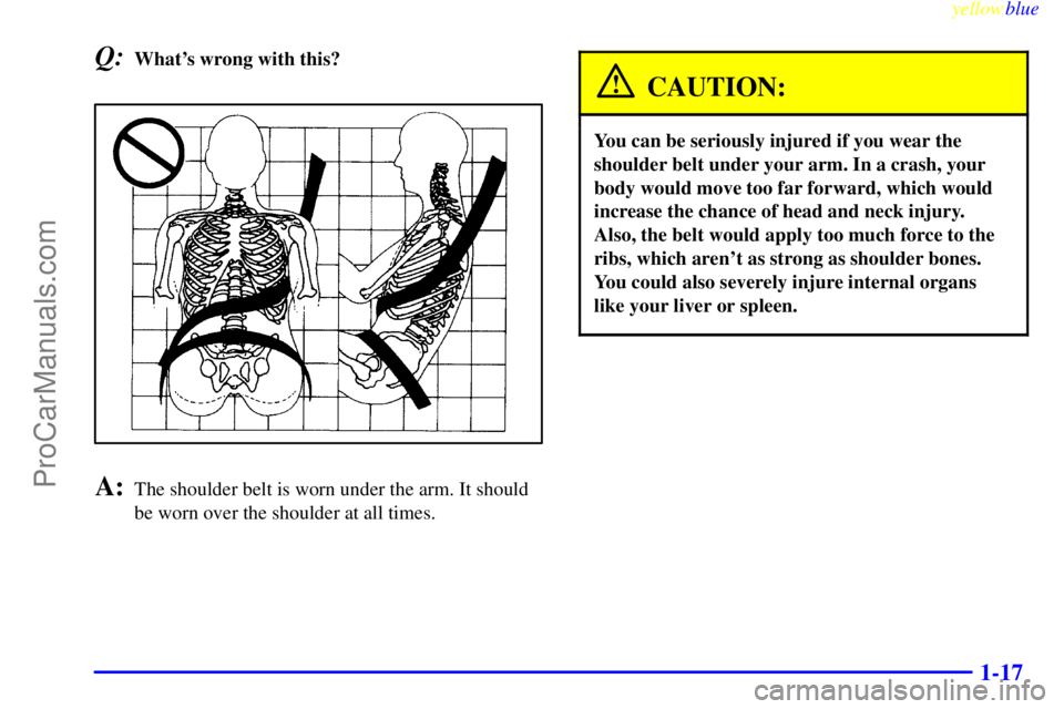 BUICK REGAL 1999  Owners Manual yellowblue     
1-17
Q:Whats wrong with this?
A:The shoulder belt is worn under the arm. It should
be worn over the shoulder at all times.
CAUTION:
You can be seriously injured if you wear the
should