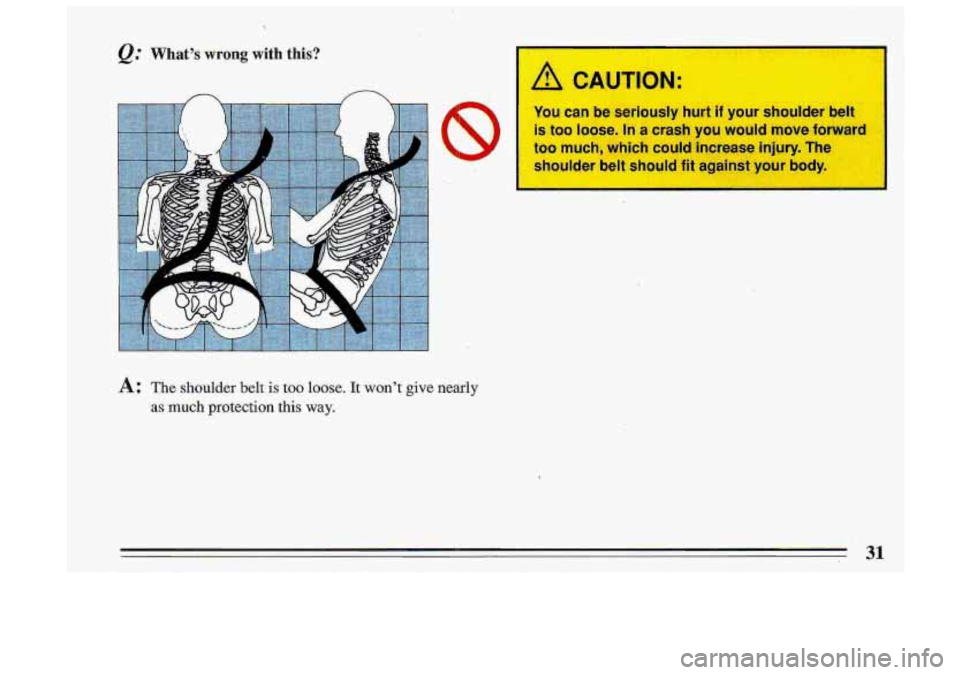 BUICK ROADMASTER 1993  Owners Manual @ What’s wrong with this? 
A: The shoulder belt-is too loose. It won’t give nearly 
as much  protection this way. 
A CA ITION: 
You can be seriously  hurt if your  shoulder  belt 
is 
too loose. I