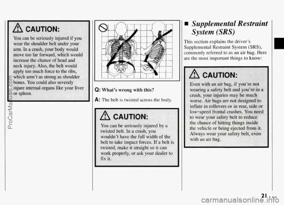 PONTIAC GRAND-AM 1994  Owners Manual Q: What’s wrong with this? 
A: The belt is twisted across the  body. 
supplemental  Restraint 
System 
(SRS) 
This section explains the driver’s 
Supplemental Restraint  System 
(SRS), 
commonly r